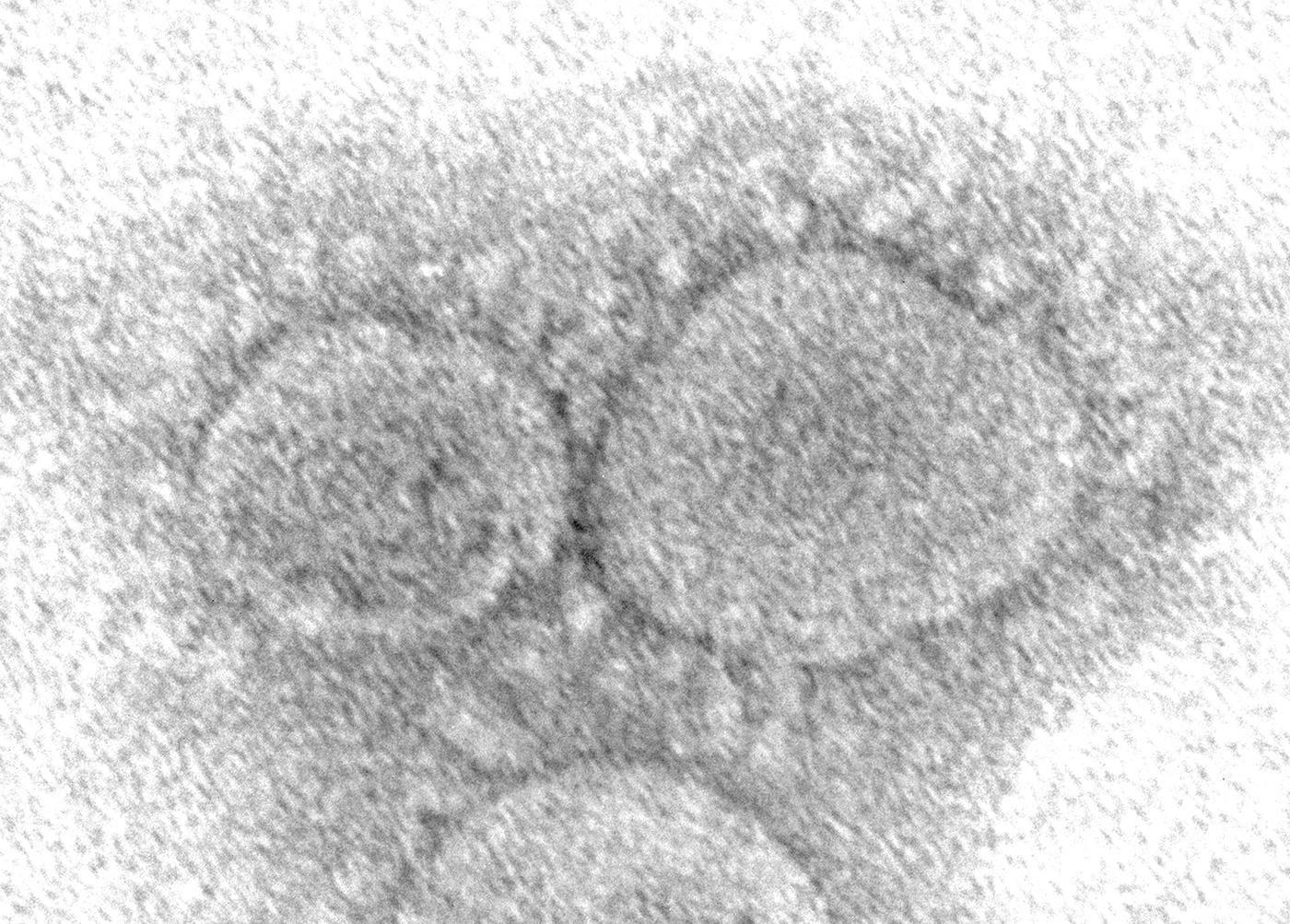 SARS-CoV-2 under an electron microscope